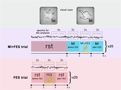 Investigating the influence of functional electrical stimulation on motor imagery related μ-rhythm suppression